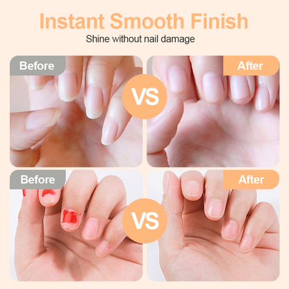 ✂️ LIMITED-TIME 50% OFF! 💅Ivosoma® 2-in-1 Smart Electric Nail Clipper & Polisher 🌟